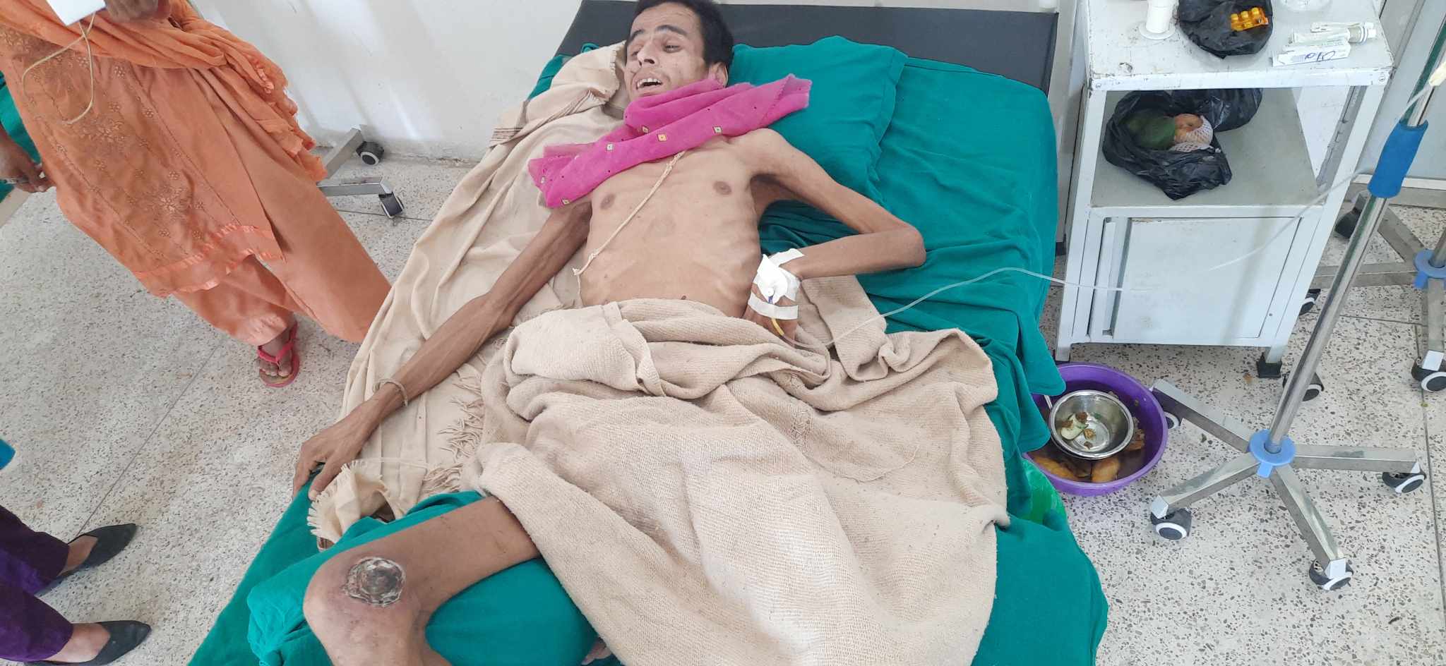 जीवन मरणको दोसाँधमा ओलानीका देव, सहयोगको अपील