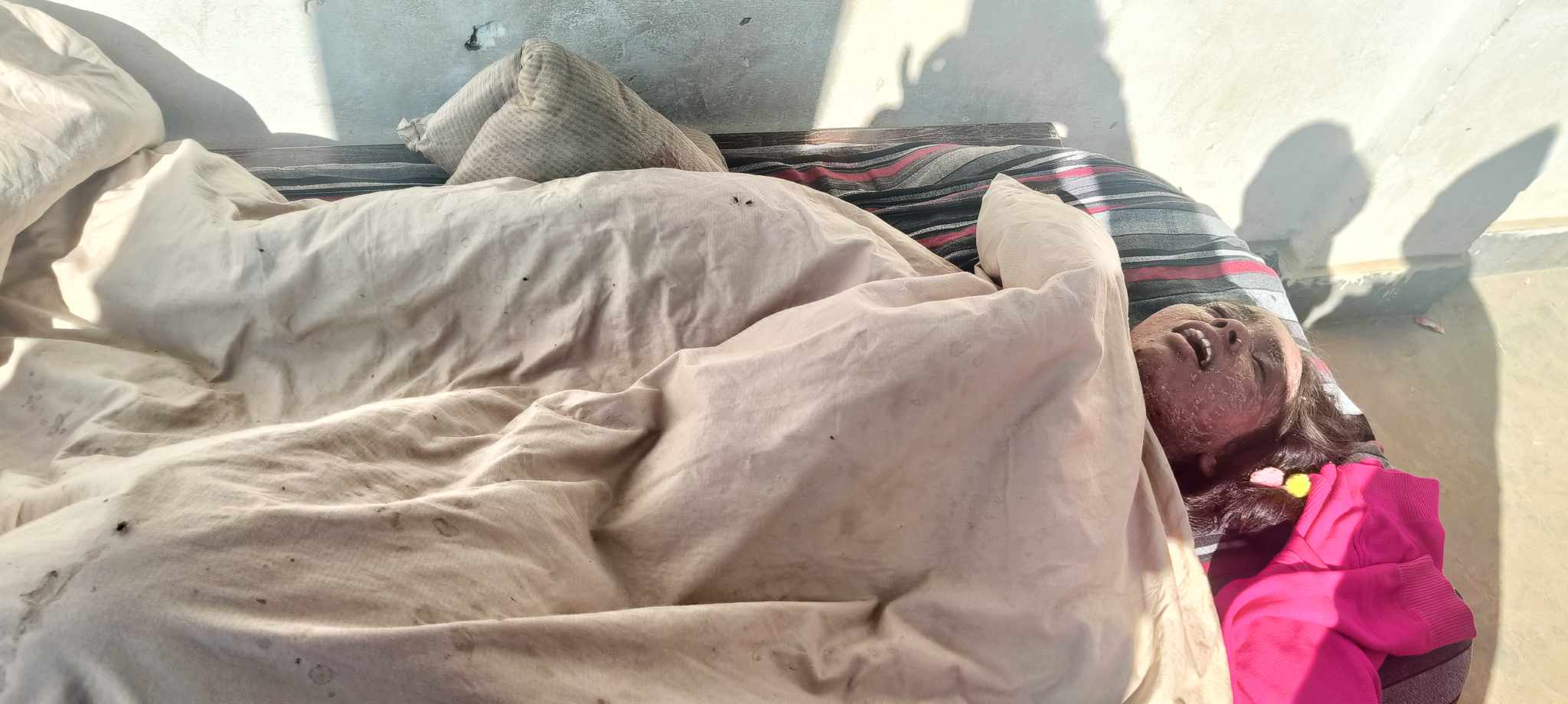 आर्थिक अभावका कारण अज्ञात रोगले थलिइन अनिता