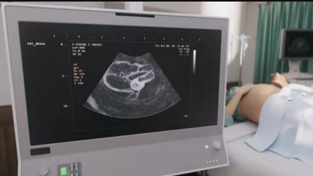 बैतडीमा भिडियो एक्सरे मेसिन खरीदका लागि अभियान सञ्चालन