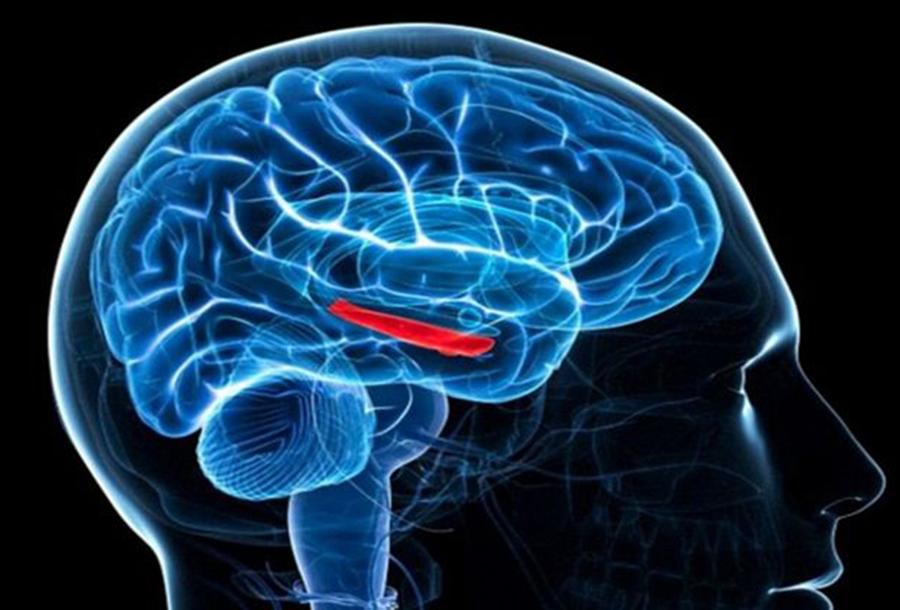 सरकारले पक्षघातको औषधि निःशुल्क उपलब्ध गराउने