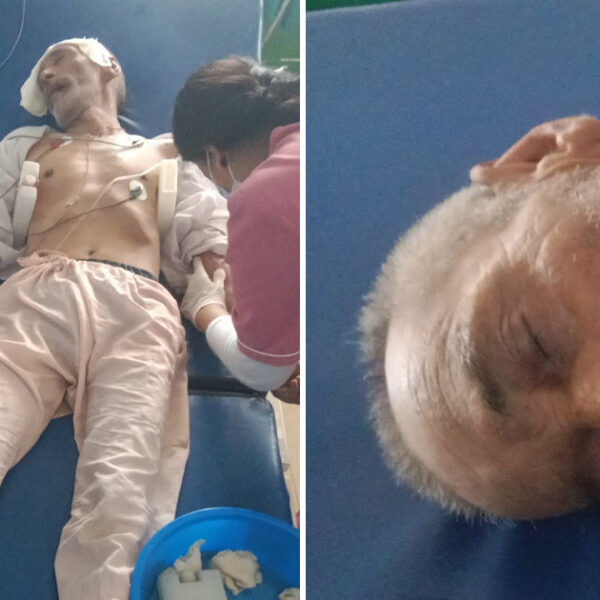 अचेत भेटिएका वृद्धको उद्धार, महाकाली अस्पतालमा उपचार हुँदै 