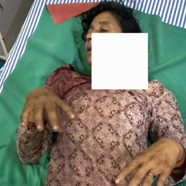 घर नजिकै घाँस काटिरहेकी बेलडाँडीकी धानादेवी बाघको आक्रमणबाट घाइते 